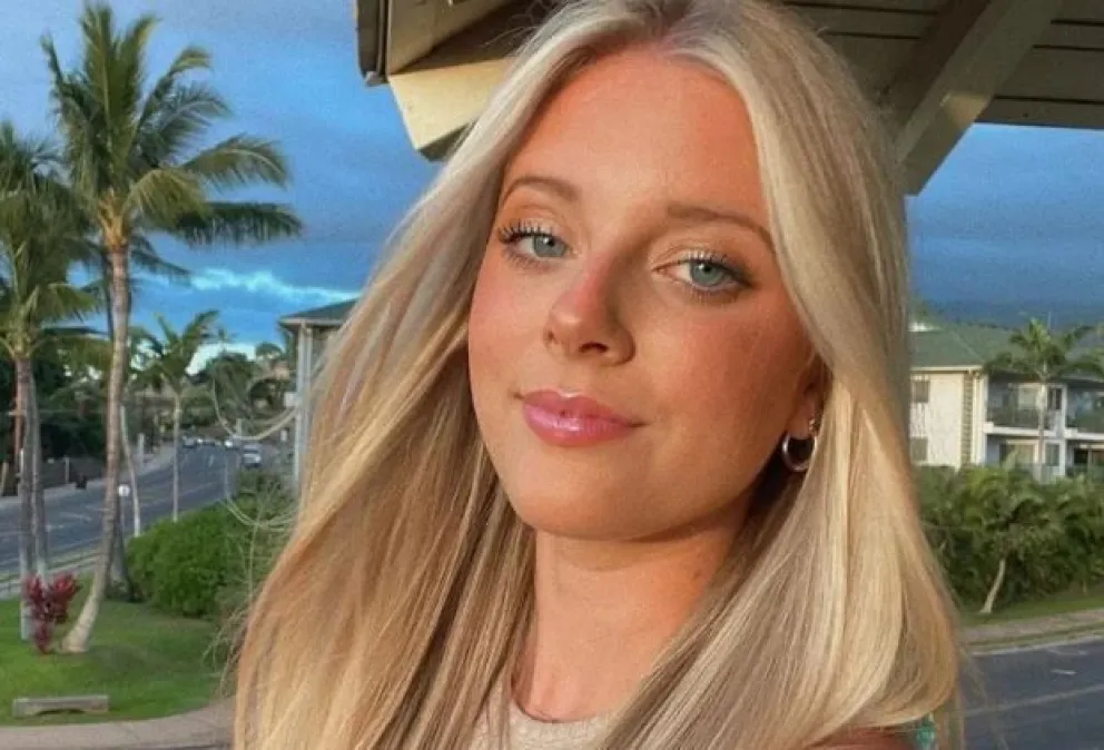 Murió la youtuber Annabelle Ham tras sufrir un ataque epiléptico en una despedida de soltera