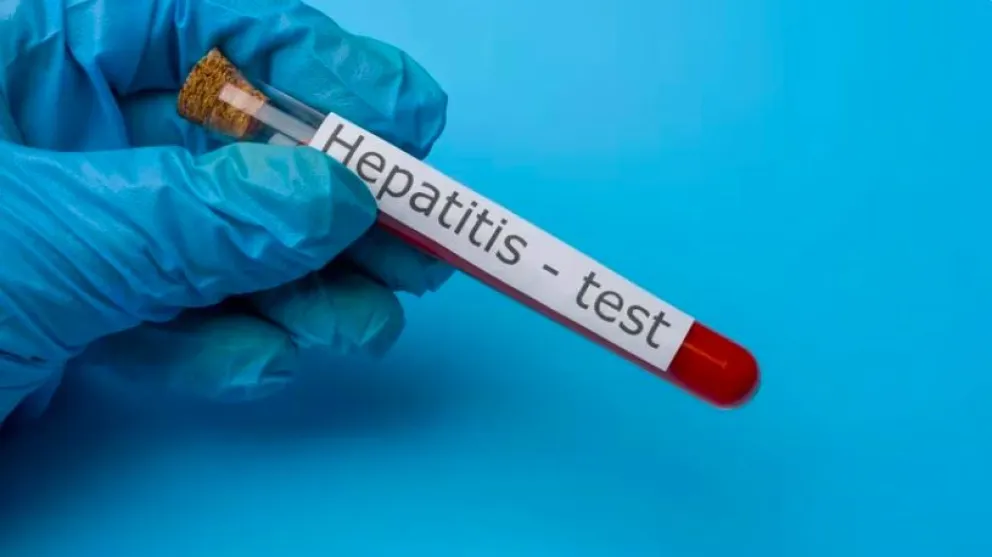 Cómo acceder a los testeos de la campaña nacional de detección de hepatitis C