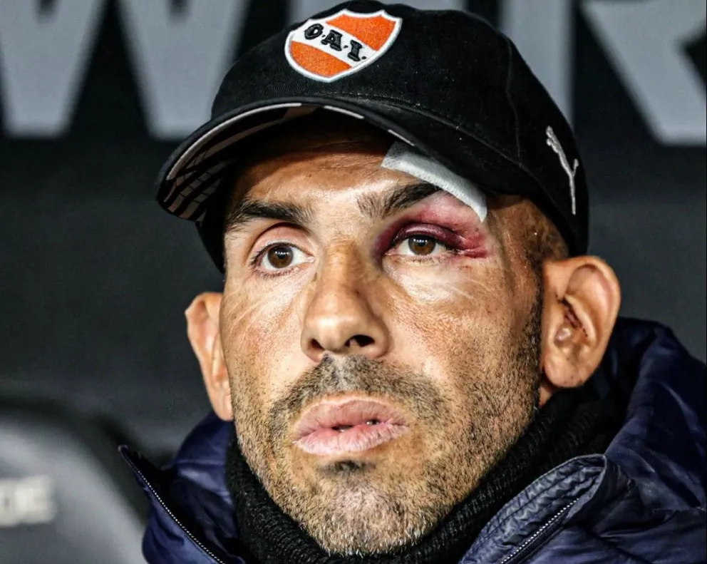 Carlos Tevez tras perder por goleada con River: “Estos partidos te dan una piña”