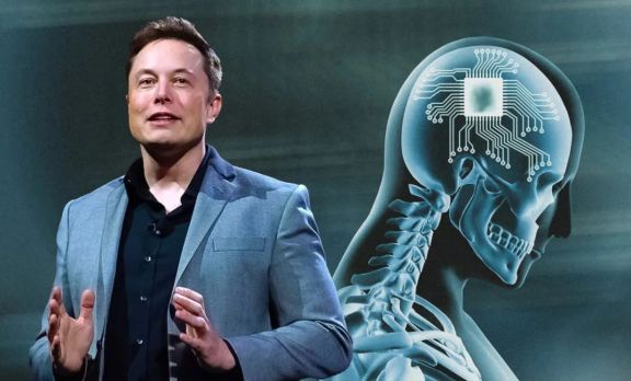 Cómo funciona Telepathy, el primer chip cerebral implantado en un ser humano por Neuralink la empresa de Elon Musk