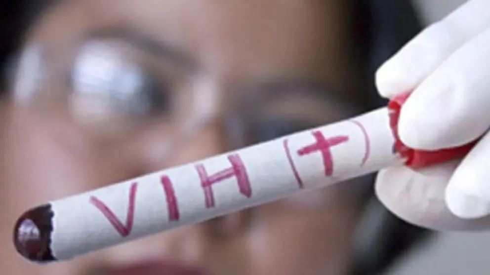 VIH: En Misiones 1 de cada 2 nuevos casos son detectados de manera tardía