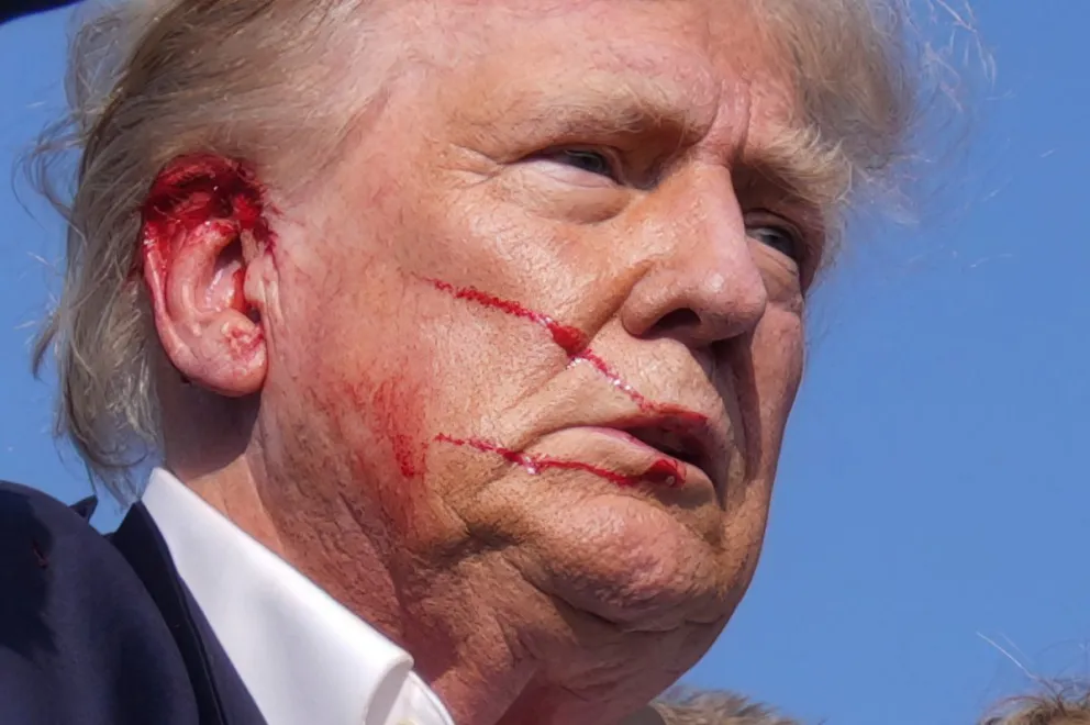 Donald Trump estaba dando un discurso cuando recibió un balazo. //Foto: AP.