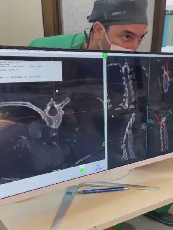 Se hizo en el Madariaga la primera cirugía de escoliosis con innovadora técnica imagen-10