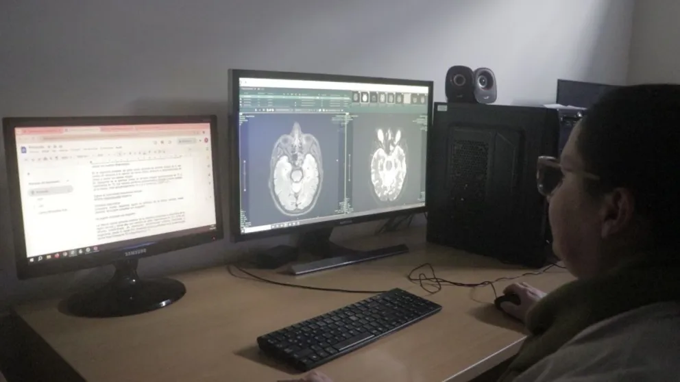 La epilepsia puede afectar a cualquier franja etaria. // Foto: Prensa Hospital Madariaga 