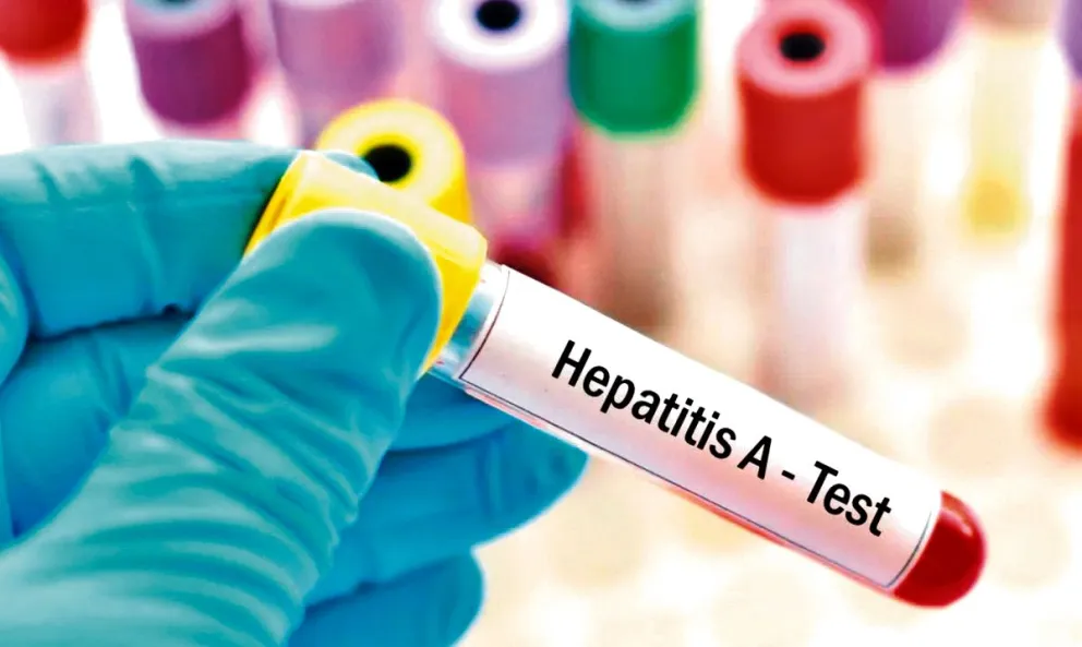 Misiones no registró casos de hepatitis A el año pasado 6 Misiones no registró casos de hepatitis A el año pasado imagen-5