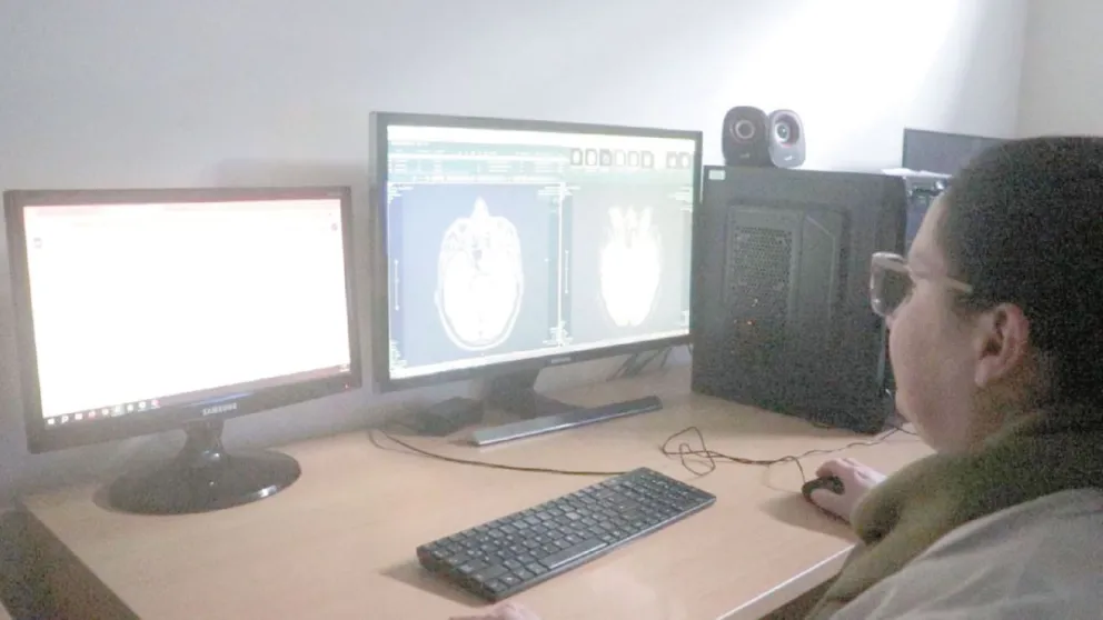 Parkinson: señales tempranas, evolución, diagnóstico y tratamiento 7 Parkinson: señales tempranas, evolución, diagnóstico y tratamiento imagen-6