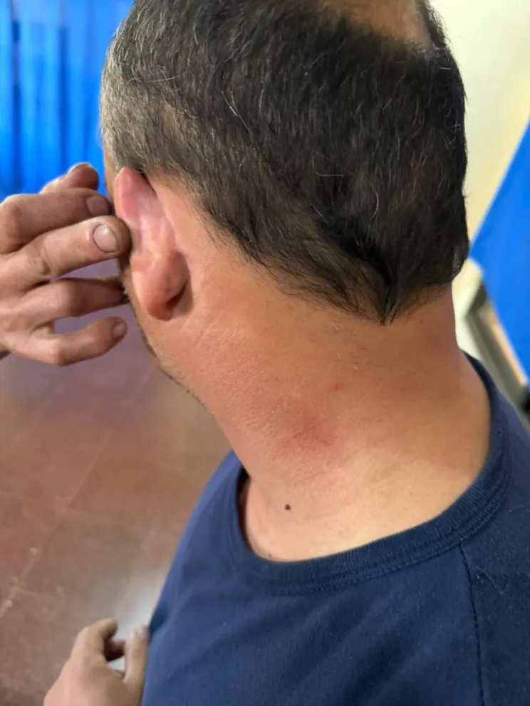 Alejandro T. indicó que recibió golpes en el cuello y detrás de la oreja izquierda.
