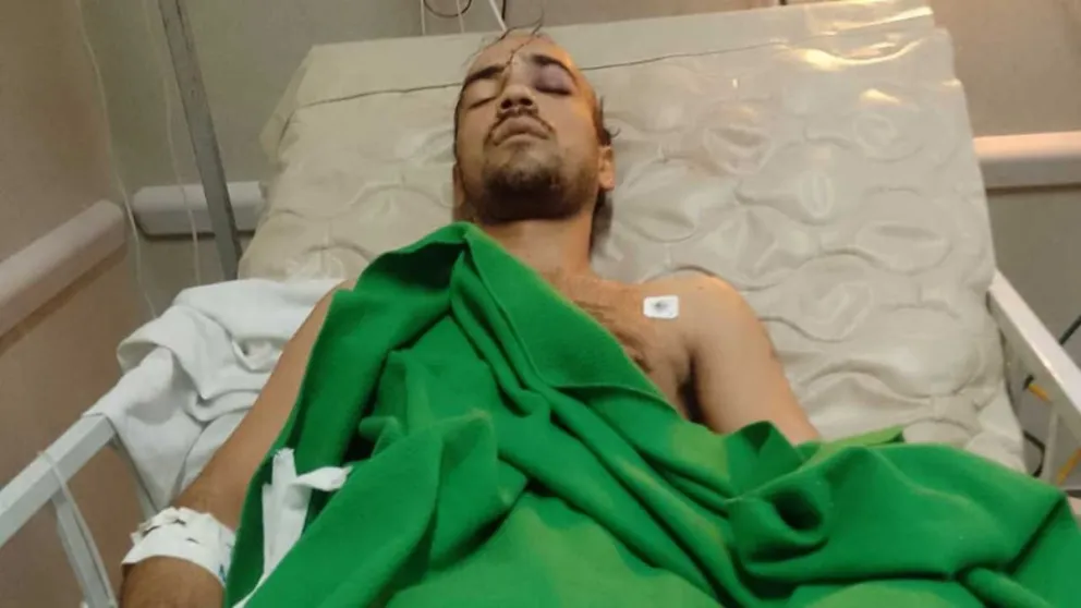Castro, quien tiene 6 puntos de sutura en la frente por uno de los cortes, estuvo tres días en terapia intensiva en el Samic.