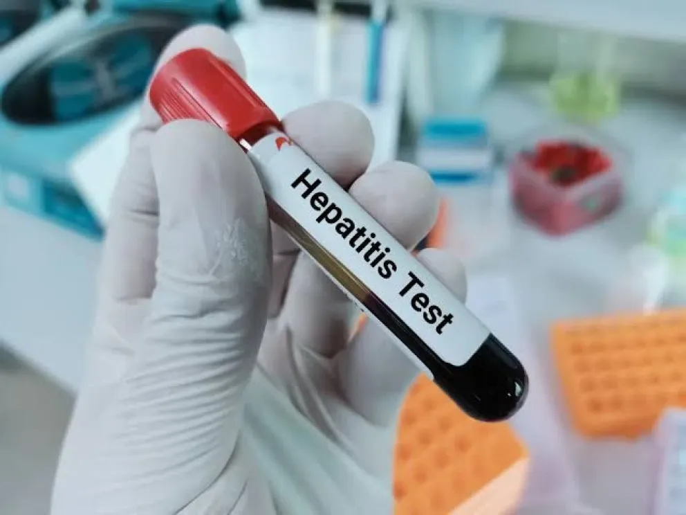 “Todos deberían hacerse el test de hepatitis al menos una vez”